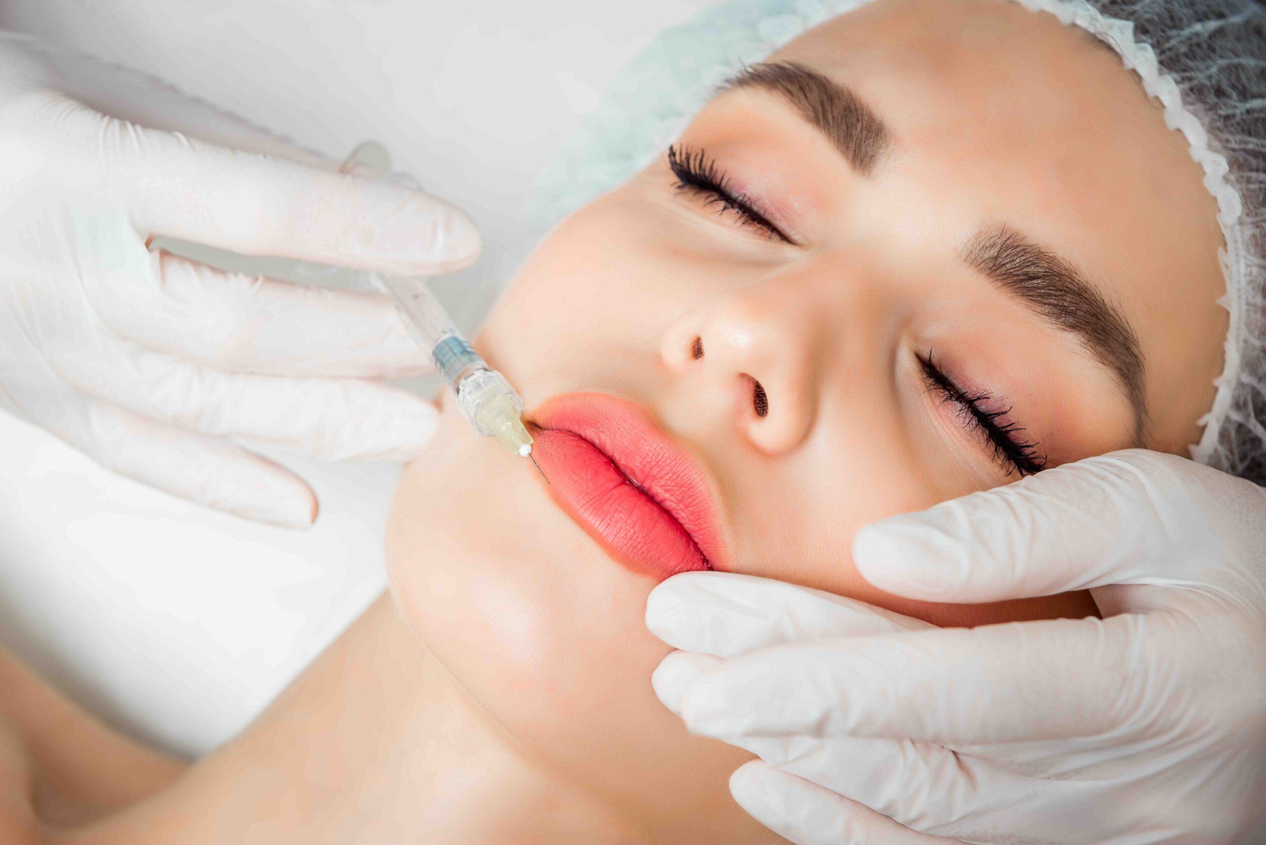 Microneedling Burlington